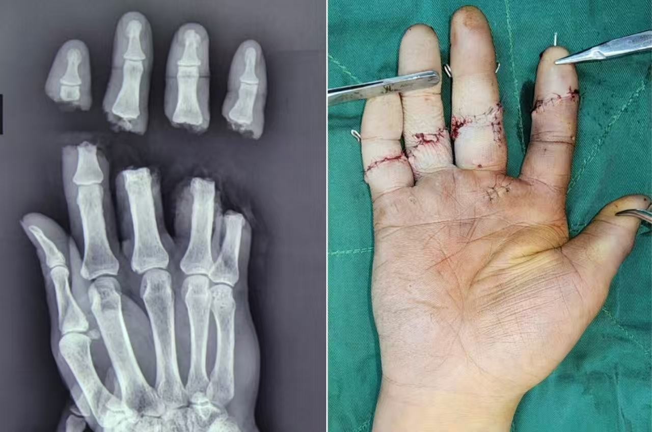 医院环境或设备 3